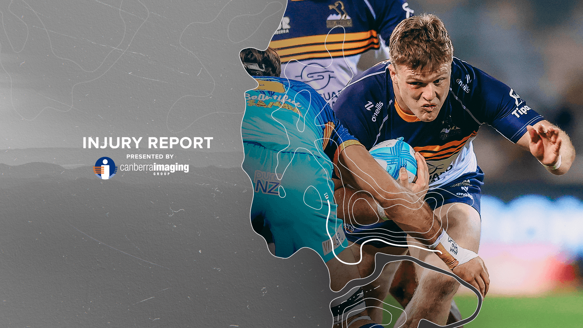 Canberra Imaging Group Injury Report: Billy Pollard